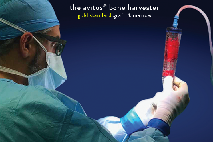Avitus® Bone Harvester (FP 1606103.620)