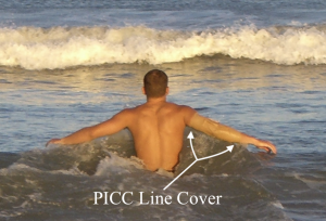 PICC Line Waterproof Cover (Prod 9620 S419.3)